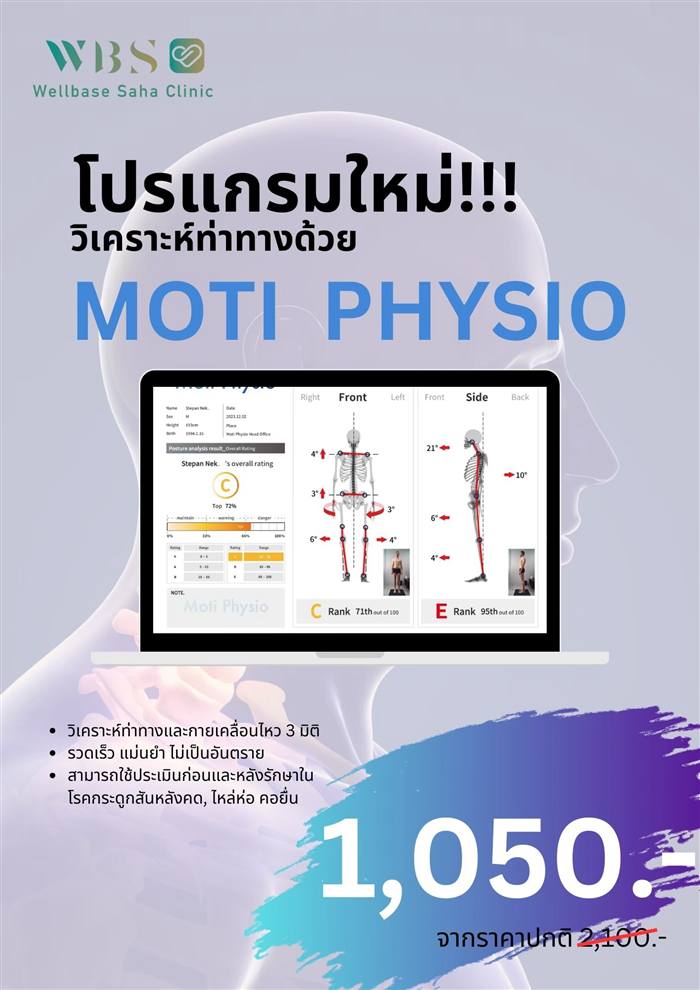 MOTI PHYSIO วิเคราะห์ท่าทาง 3 มิติ